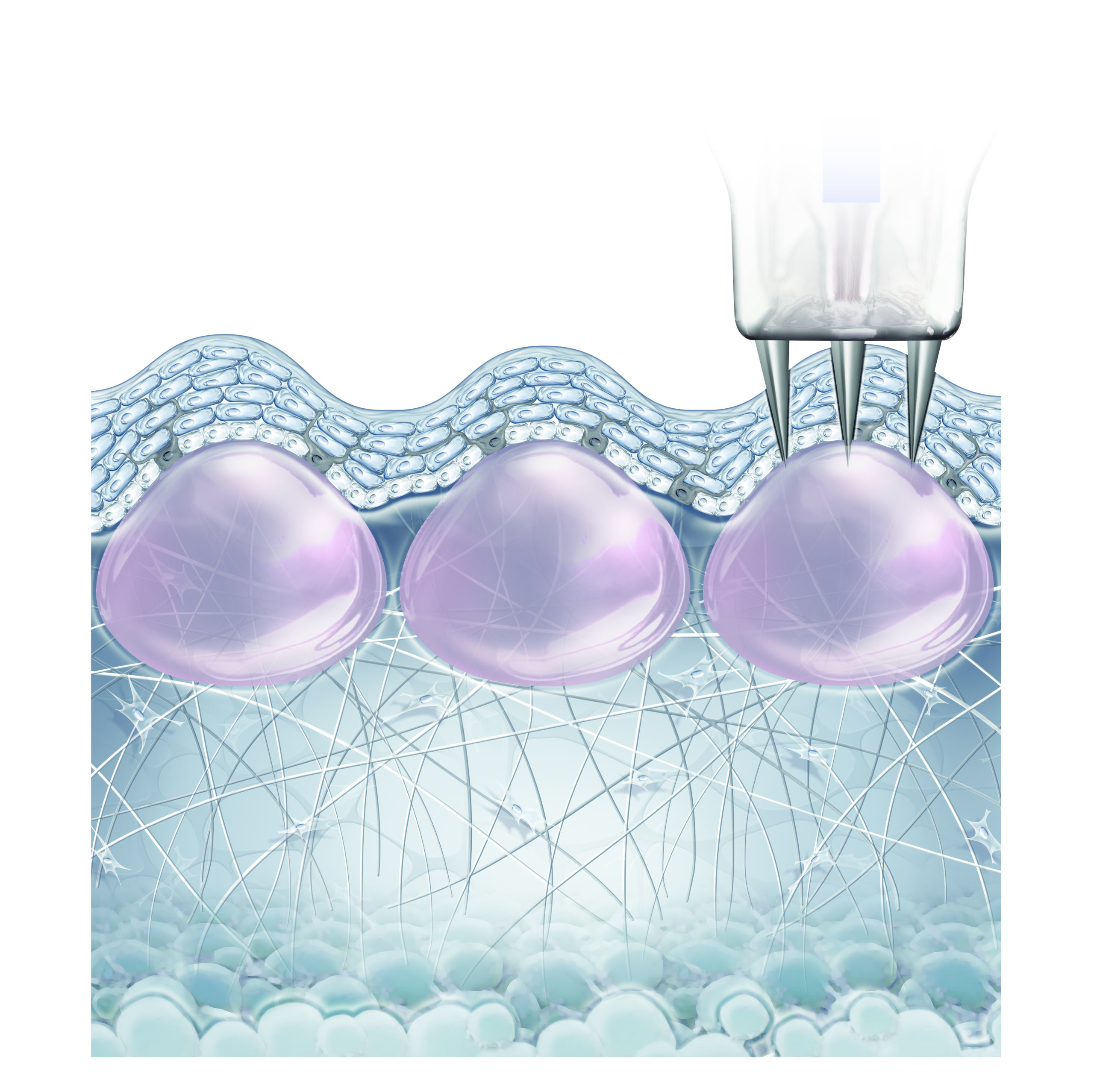NANOSOFT_IMAGE2-PAPULES-PRINT